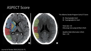 Role of Imaging in Acute Stroke Patients Practical Guide for GP.pdf