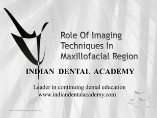 INDIAN DENTAL ACADEMY
Leader in continuing dental education
www.indiandentalacademy.com

 