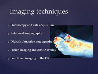 Op Angiogram Role of intraoperative angiography in vascular surgery | PPTX