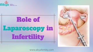 Role of
Laparoscopy in
Infertility
www.aikyafertility.com
 