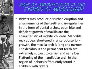 Comprehensive Overview of Nutrition's Role in Craniofacial Growth and ...
