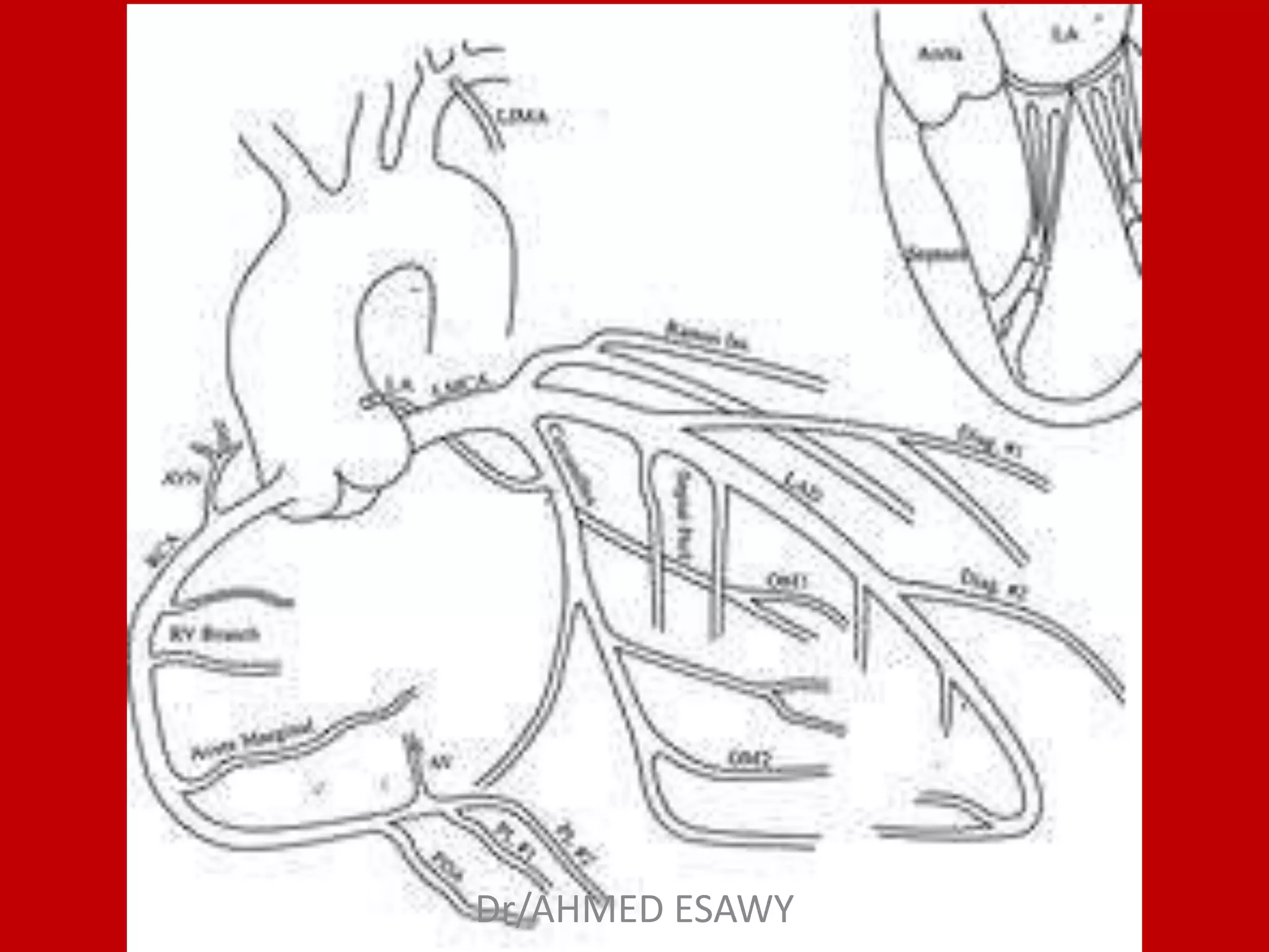 Role of MDCT in coronary artery part 1 (CT anatomy) Dr Ahmed Esawy | PPT