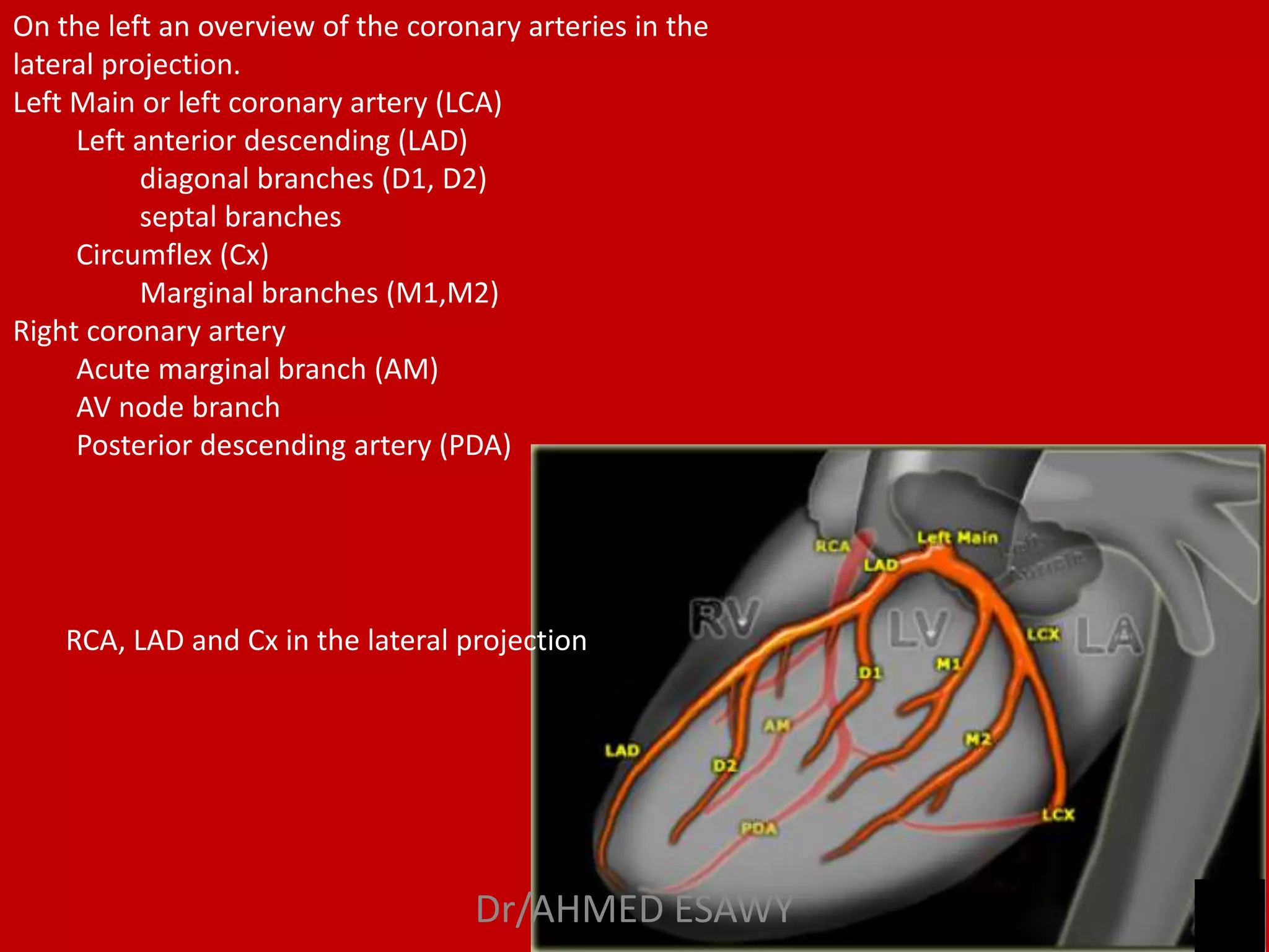 Role of MDCT in coronary artery part 1 (CT anatomy) Dr Ahmed Esawy | PPT