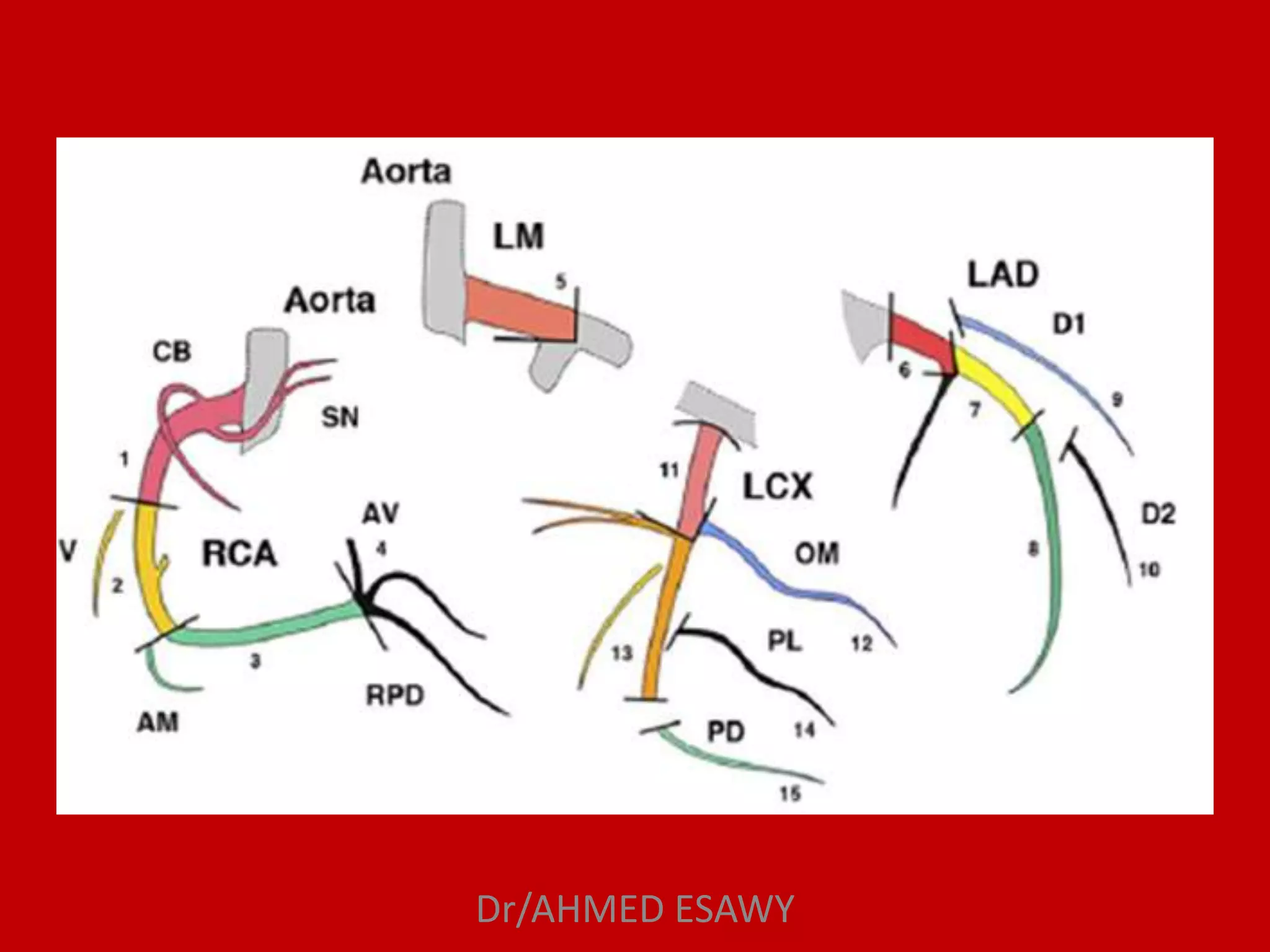 Role of MDCT in coronary artery part 1 (CT anatomy) Dr Ahmed Esawy | PPT