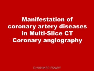 Manifestation of
coronary artery diseases
in Multi-Slice CT
Coronary angiography
Dr/AHMED ESAWY
 