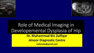 Role of Medical Imaging in
Developemental Dysplasia of Hip
Dr. Muhammad Bin Zulfiqar
Alnoor Diagnostic Centre
radiombz@gmail.com
 