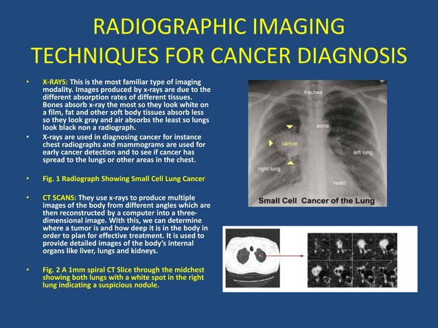ROLE OF MEDICAL RADIOGRAPHY IN DIAGNOSIS AND TREATMENT OF CANCER_053146 ...