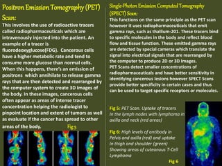 ROLE OF MEDICAL RADIOGRAPHY IN DIAGNOSIS AND TREATMENT OF CANCER_053146 ...