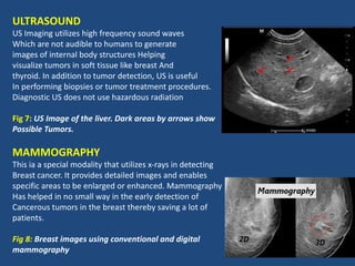 ROLE OF MEDICAL RADIOGRAPHY IN DIAGNOSIS AND TREATMENT OF CANCER_053146 ...