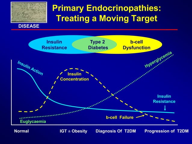 Role of metformin in dm2 & glibenclamide combination | PPTX