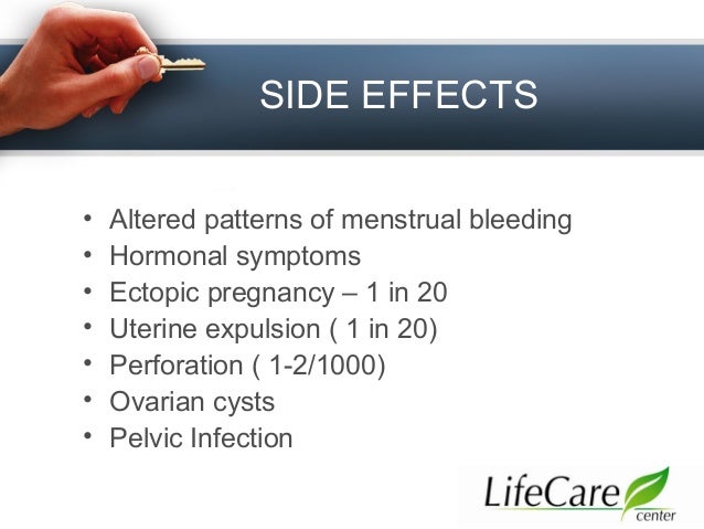 Levonorgestrel Side Effects Mirena