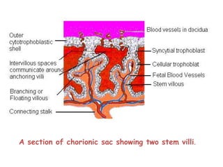 Chorionic Ridge Role of mri in placental disorders new | PPTX