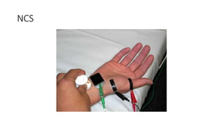 Role of NCS in Nerve injuries.pptx