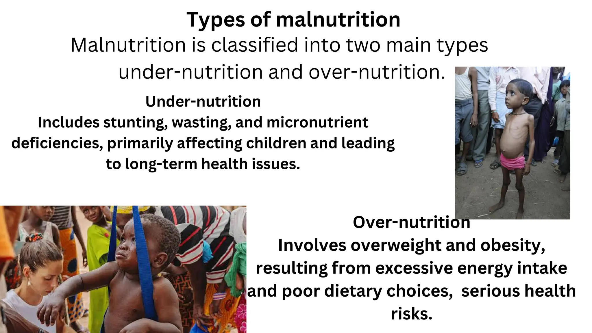 Role of Nutrition in Malnourished Children.pdf.pdf