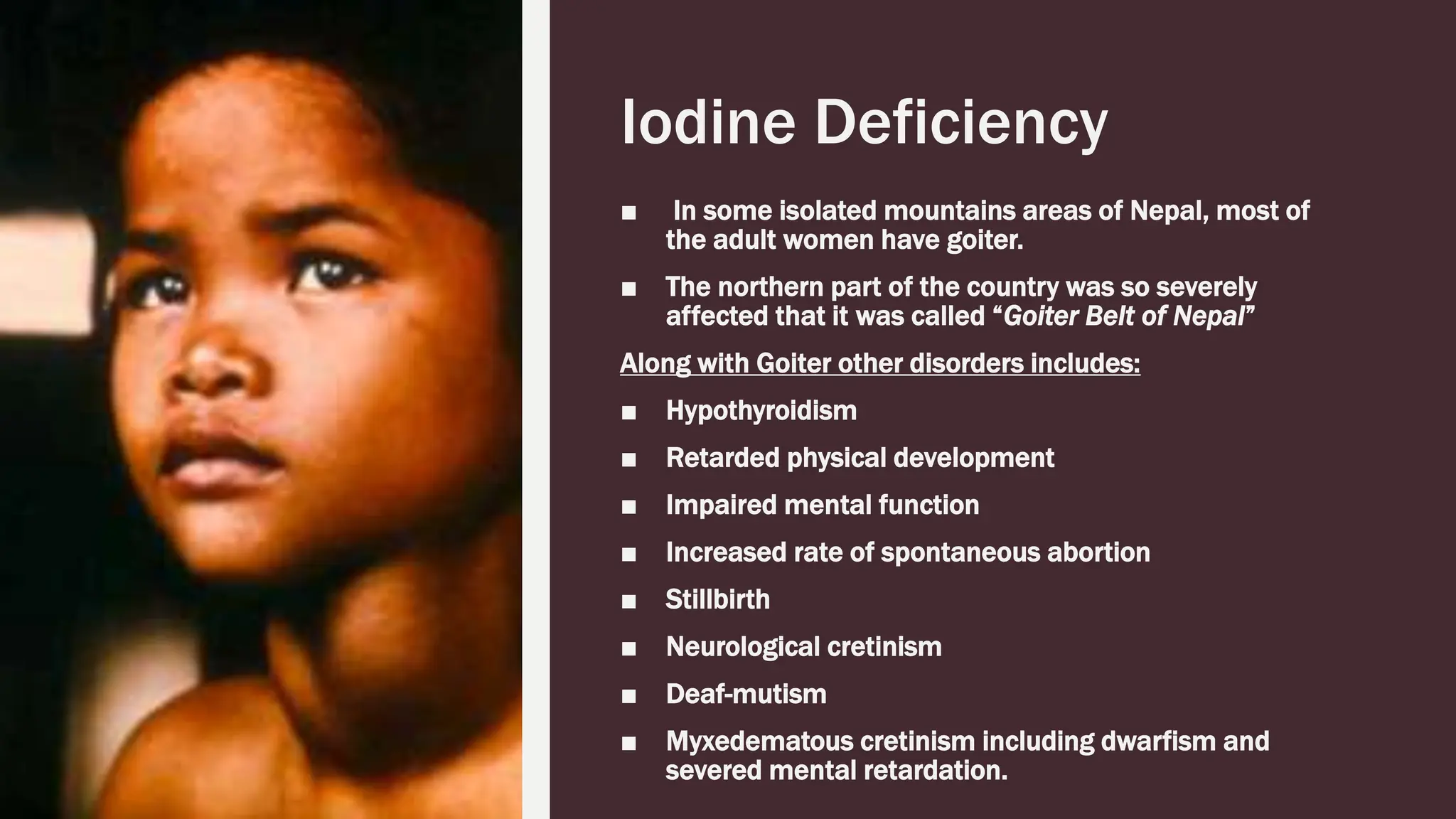 Role of nutrition in prevention of disease.pptx