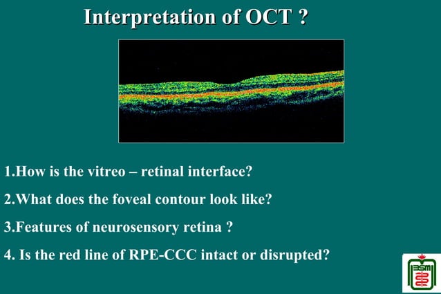 Optical Coherence Tomography (OCT) | PPT