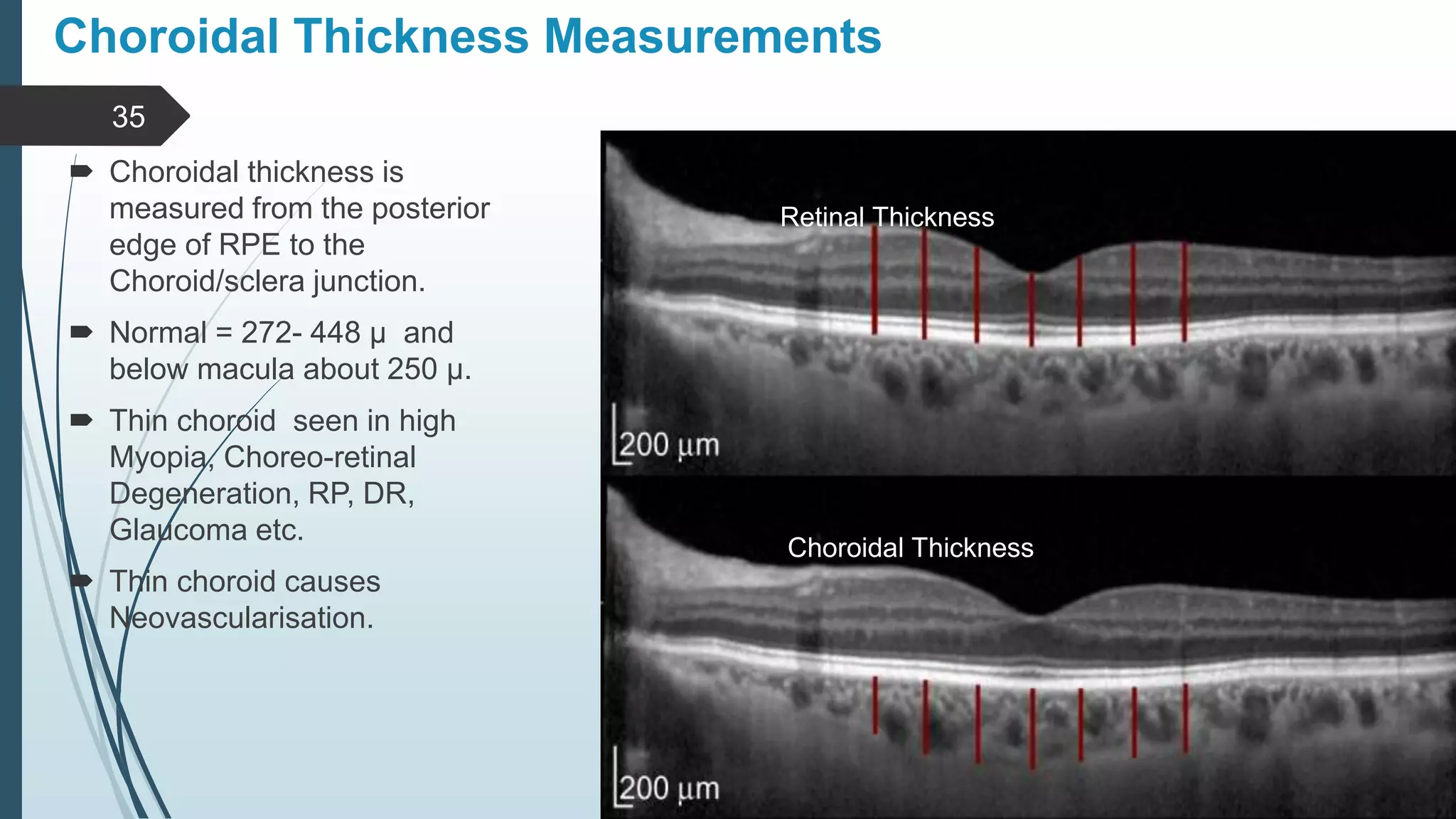 Role of oct in ophthalmology PPTX
