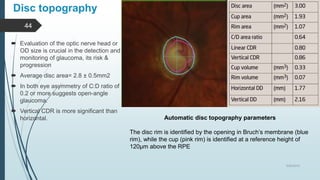 Role of oct in ophthalmology | PPTX