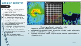 Normal Gcl Map Role of oct in ophthalmology | PPTX