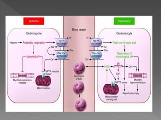 Role of oxidative stress in coronary artery disease | PPTX
