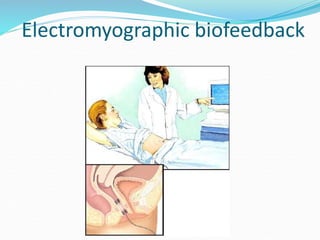 Electromyographic biofeedback
 
