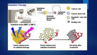 Role of radiotherapy in oral ca ppt for csm | PPTX