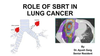 ROLE OF SBRT IN
LUNG CANCER
By
Dr. Ayush Garg
Senior Resident
 