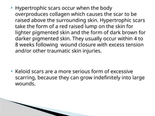 ROLE OF SILICON GEL IN PORT SITE SCAR REDUCTION | PPTX