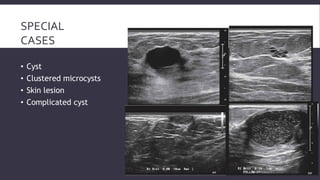 Role of sonography and mri in breast pathology pdf | PDF