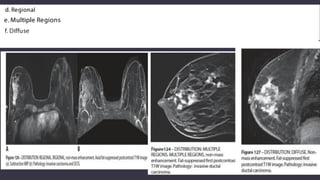 Role of sonography and mri in breast pathology pdf | PDF