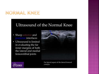 Role of sonography in knee joint diseases | PPT