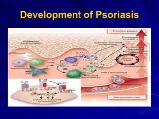 Role of stat3 protein & thelper 17 cell in psoriasis development by ...