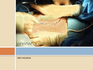 Operation First Incision roleofsurgeryincarcinomabreastn-191017170949.pptx