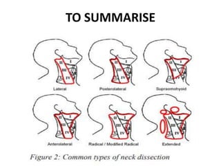 Role Of Surgery In Management of Neck Nodes 2 - Copy.pptx