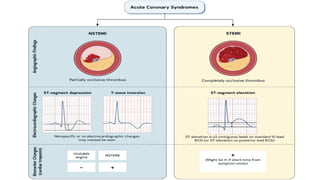 Role of Thrombolysis in Managing Coronary Artery Disease and Acute ...