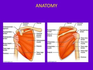Role of ultrasound in clinical evaluation of shoulder Dr. Muhammad Bi…