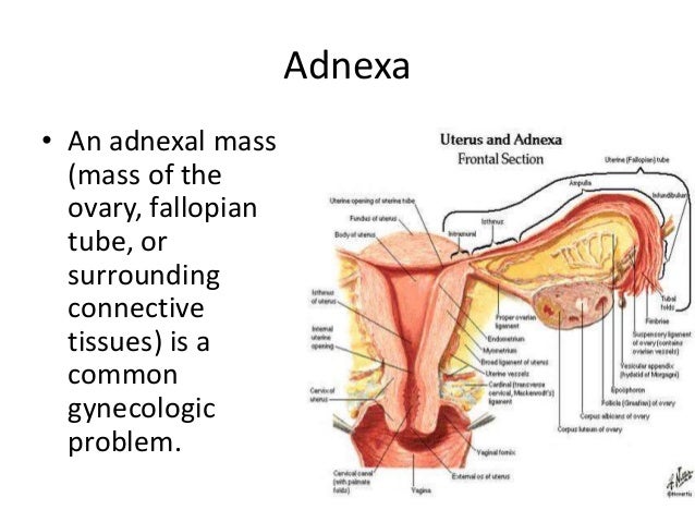 Role of ultrasound in ovarian lesions