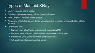this is the ppt aboutRole of X-rays in.pptx