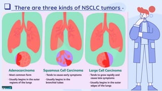 Non Small cell Lung Cancer | PPT