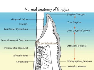 Normal anatomy of Gingiva
 