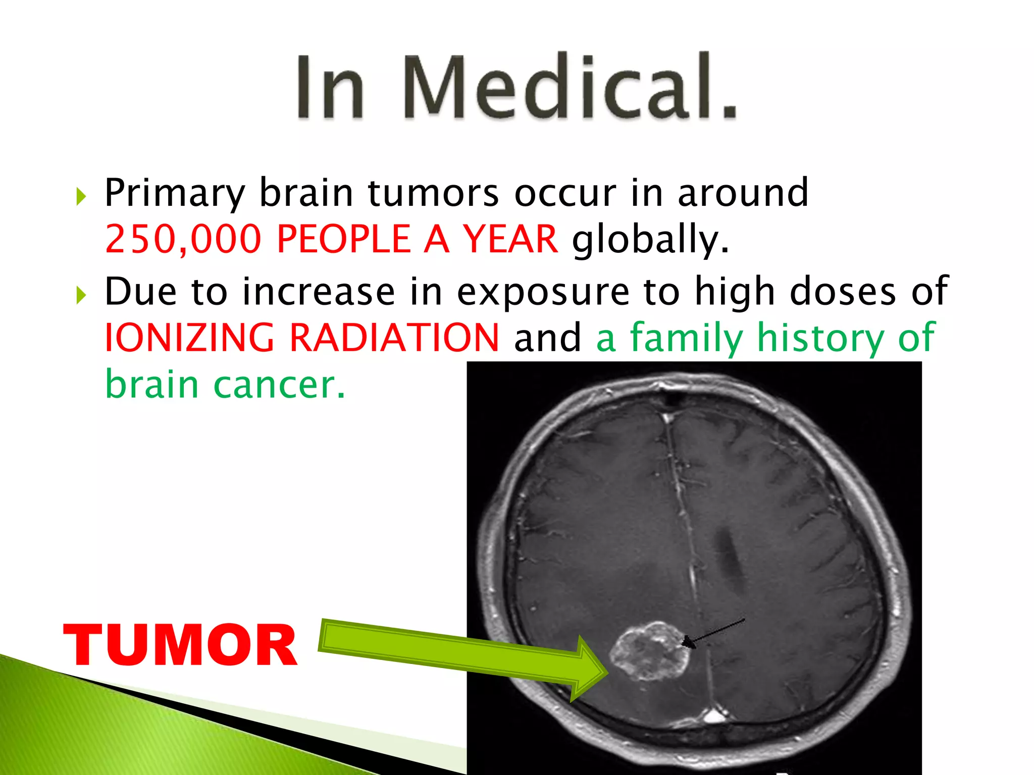  Primary brain tumors occur in around
250,000 PEOPLE A YEAR globally.
 Due to increase in exposure to high doses of
IONIZING RADIATION and a family history of
brain cancer.
TUMOR
 