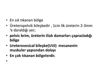 • En sık tıkanan bölge
• Üreteropelvik bileşkedir , 1cm lik üreterin 2-3mm
‘e daraldığı yer;
• pelvic brim, üreterin iliak damarları çaprazladığı
bölge
• Ureterovesical bileşke(UVJ) mesanenin
muskuler yapısndan dolayı
• En çok tıkanan bölgelerdir.
•

 