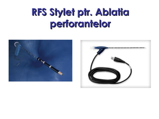 RFS StyletRFS Stylet ptr.ptr. AblatAblatiaia
perforaperforantelorntelor
 