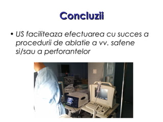 ConcluziiConcluzii
• US faciliteaza efectuarea cu succes a
procedurii de ablatie a vv. safene
si/sau a perforantelor
 