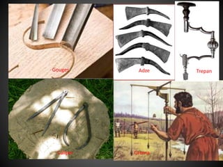 Gouges Adze Trepan
Caliper Groma
 