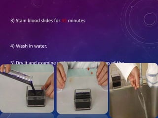 3) Stain blood slides for 45 minutes
4) Wash in water.
5) Dry it and examine under oil immersion lens of the
microscope.
 