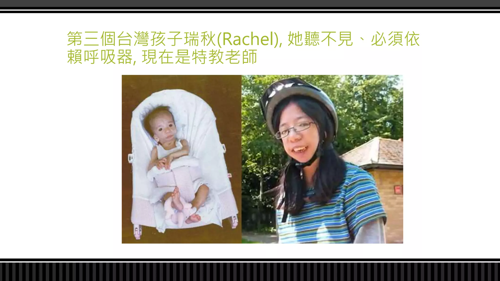 第三個台灣孩子瑞秋(Rachel), 她聽不見、必須依
賴呼吸器, 現在是特教老師
 