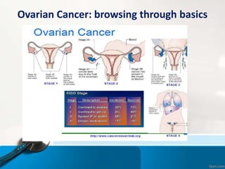 ROMA (Risk of Ovarian Malignancy Algorithm) | PPTX
