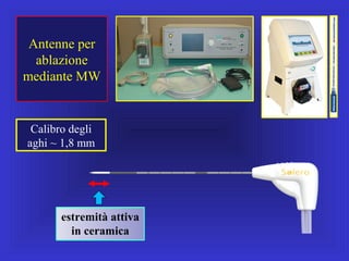 Antenne per
ablazione
mediante MW
Calibro degli
aghi ~ 1,8 mm
estremità attiva
in ceramica
 