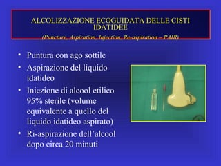 • Puntura con ago sottile
• Aspirazione del liquido
idatideo
• Iniezione di alcool etilico
95% sterile (volume
equivalente a quello del
liquido idatideo aspirato)
• Ri-aspirazione dell’alcool
dopo circa 20 minuti
ALCOLIZZAZIONE ECOGUIDATA DELLE CISTI
IDATIDEE
(Puncture, Aspiration, Injection, Re-aspiration – PAIR)
 